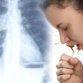 6 головних симптомів, які можуть вказувати на розвиток «тихої» пневмонії