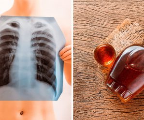 Потужний сироп для очищення легенів — народний засіб