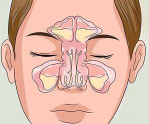 Що робити, коли заклало ніс: 6 порад, щоб очистити закладений ніс за декілька хвилин