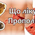 Прополіс – лiкує виразки, допомагає при болях в суглобах і м’язах