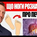 Ноги кричать SOS: 5 тривожних сигналів від вашої печінки